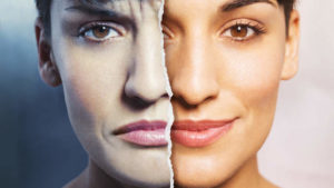 Bipolar disorder at the Apex Clinic site example where a women's face is split into two emotions sad and happy face